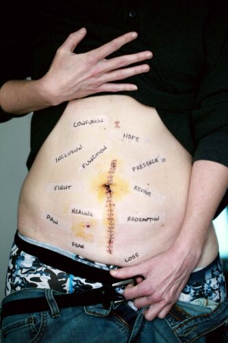 Coping with Infertility: Treatment Options for Couples 3